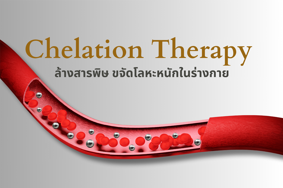 คีเลชั่นบำบัด ล้างพิษหลอดเลือด (Chelation Therapy)